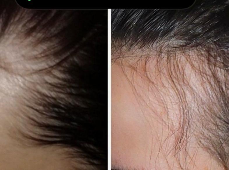 Organic | Keratin Treatment Hair Oil